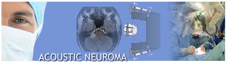 Acoustic Neuroma Banner_Ear Institute of Chicago