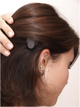 Soundbridge Amade Sound Processor on Patient