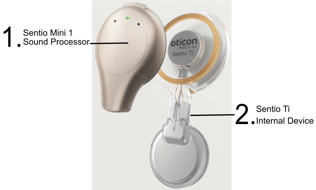 Images of the Sentio mini sound processor and the Sentio internal device